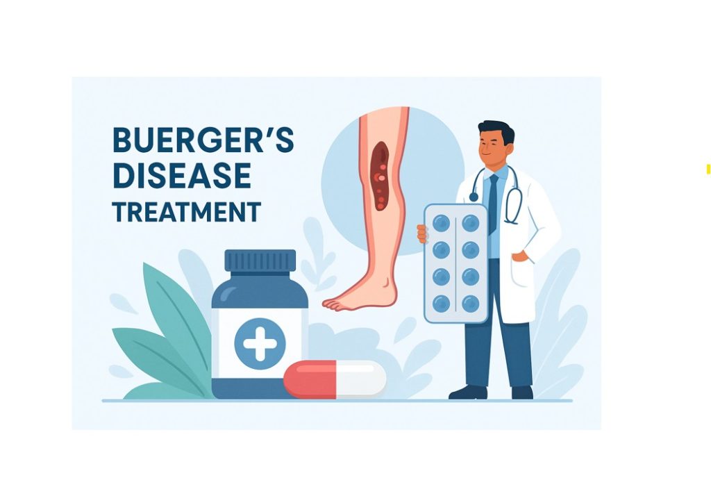 درمان دارویی بیماری برگر